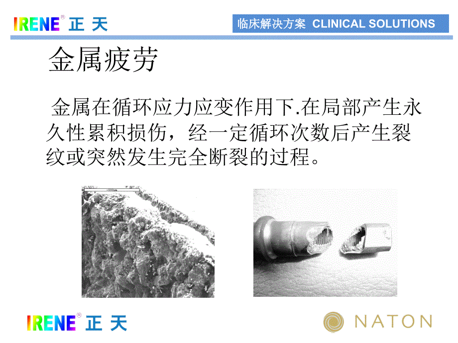 骨科医生的难题-内固定断裂_第3页