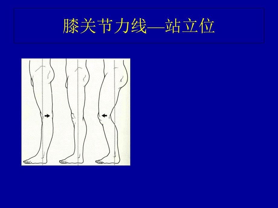 膝关节查体2014_第5页