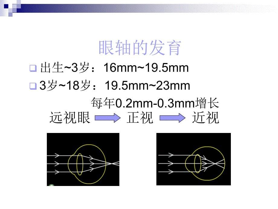 爱眼知识科普基础讲座_第5页