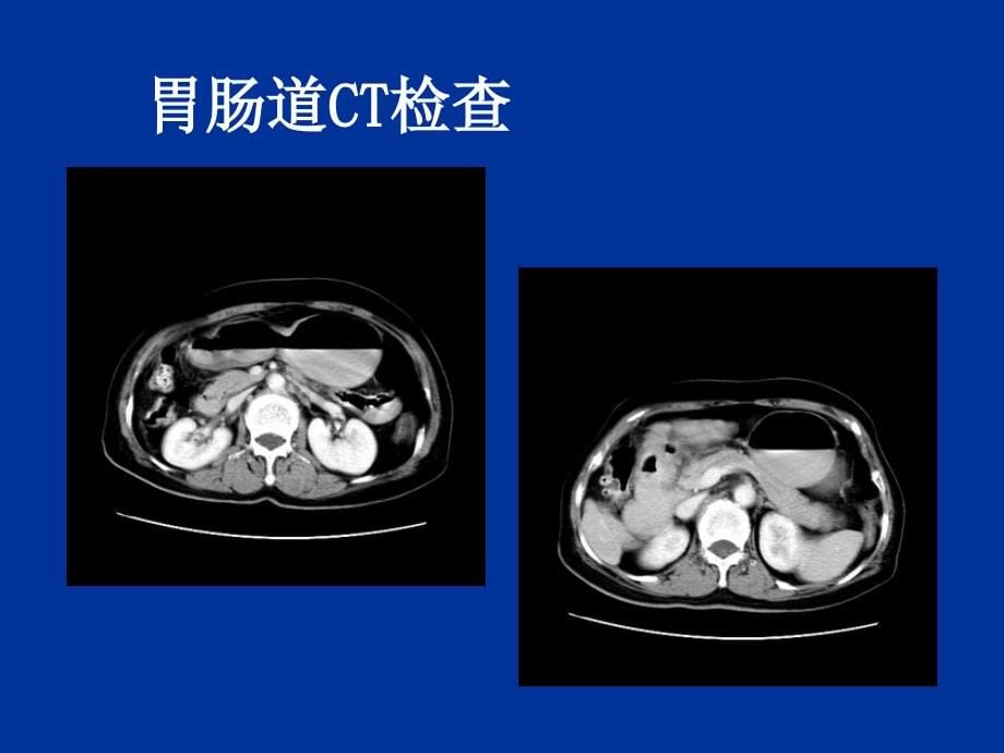 医学影像学-消化系统_第5页