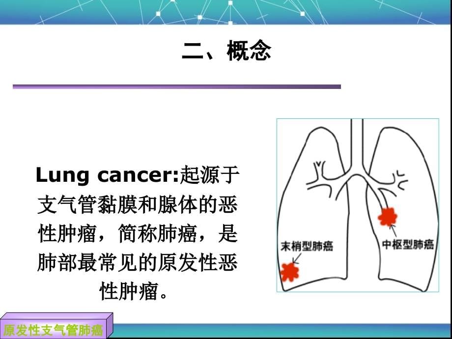 原发性支气管肺癌病人护理更改_第5页