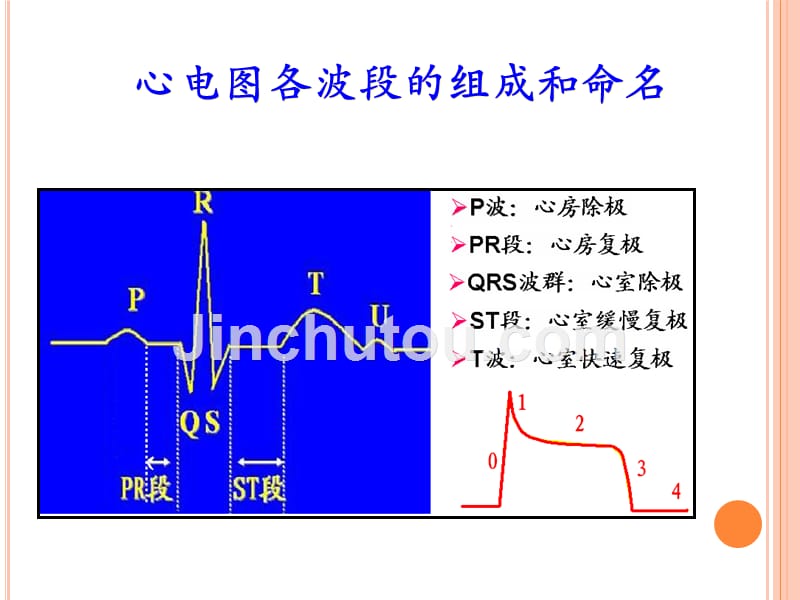 临床常见心律失常识别及治疗_第3页