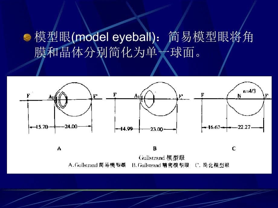 屈光不正斜视和弱视(眼科学)_第5页