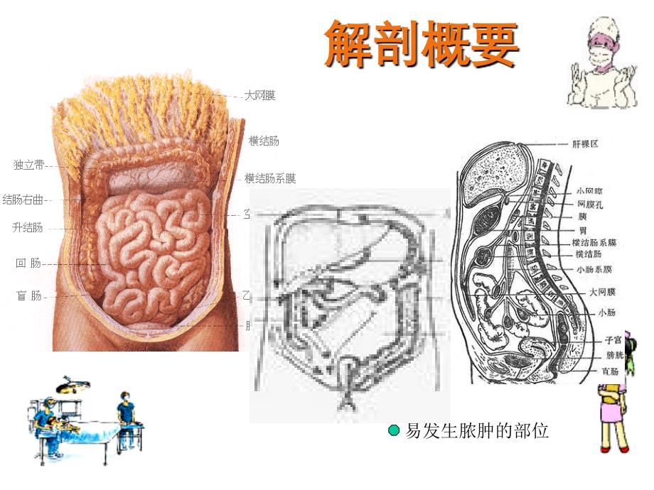 急性化脓性腹膜炎病人护理_第3页