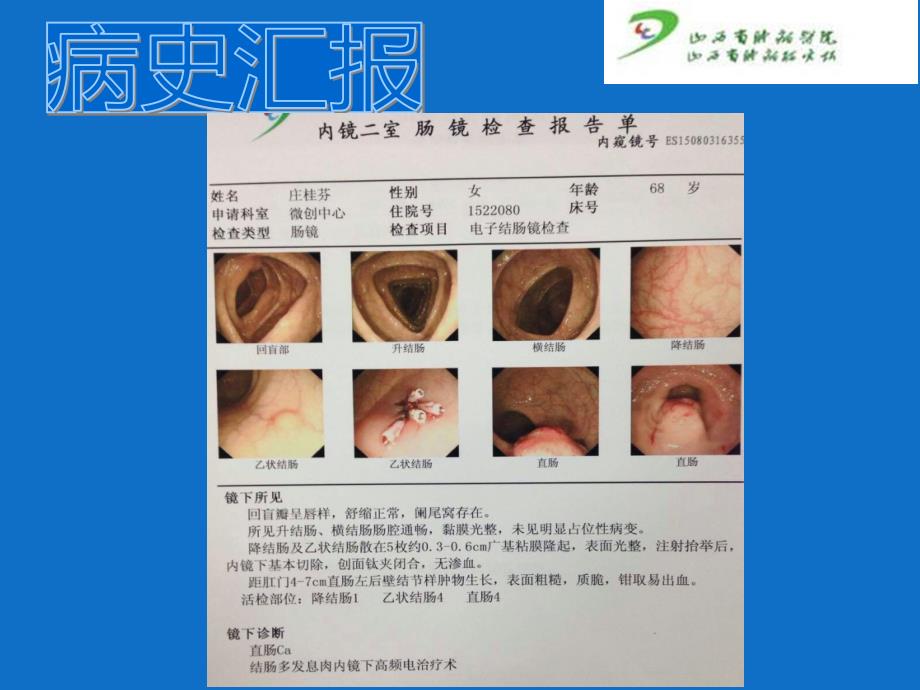 直肠癌护理查房新__第4页