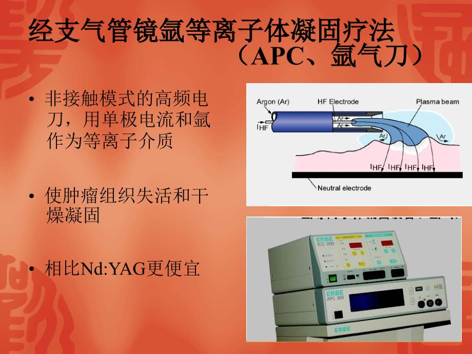 支气管镜下气道腔内疾病介入治疗(APC、冷冻)_第4页