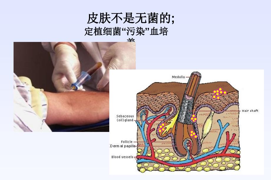 明确血培养临床意义_第2页