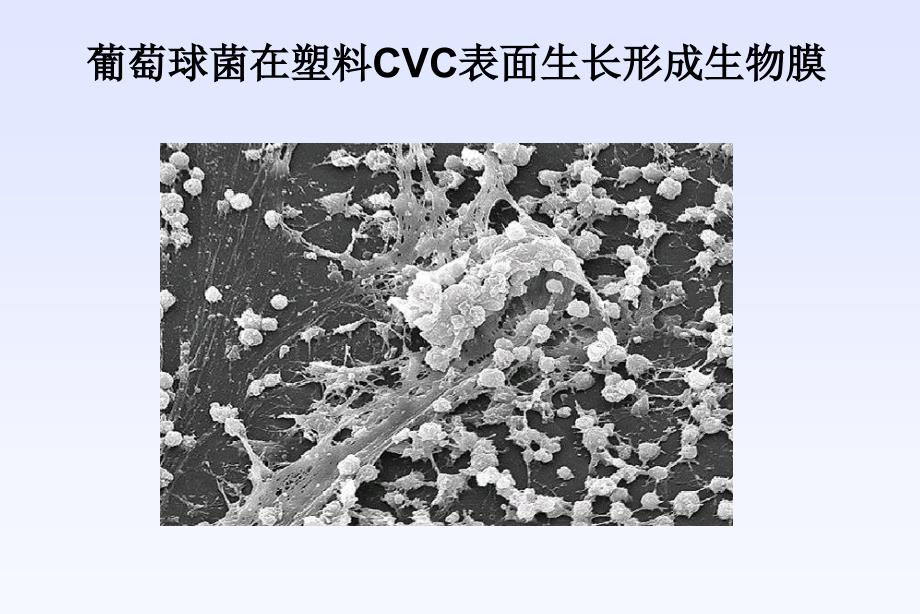 明确血培养临床意义_第4页