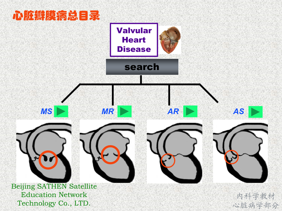 最全心脏瓣膜病课件_第3页