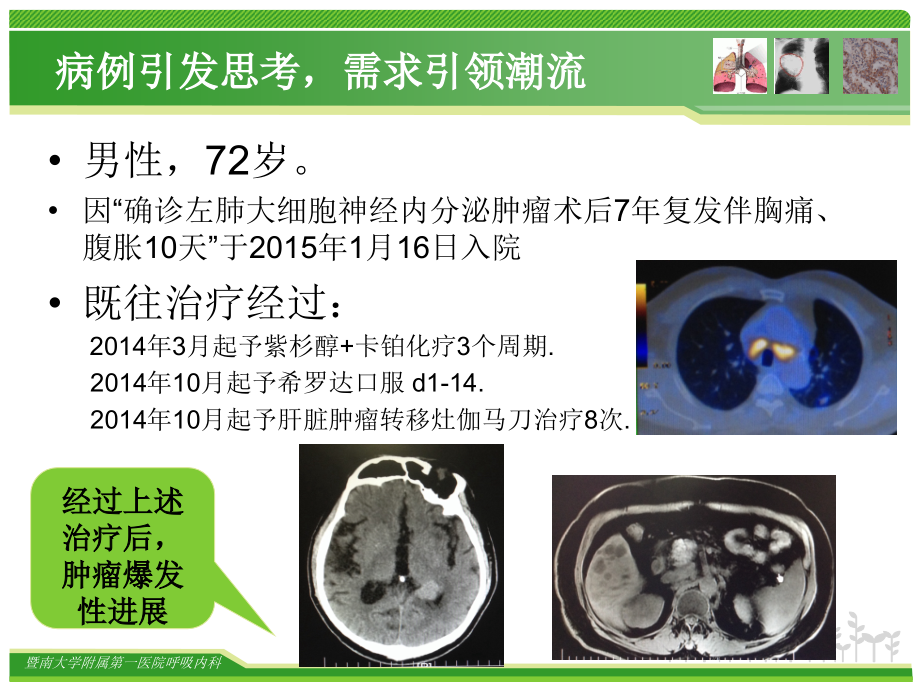 肺癌的免疫靶向治疗-蔡兴东_第2页