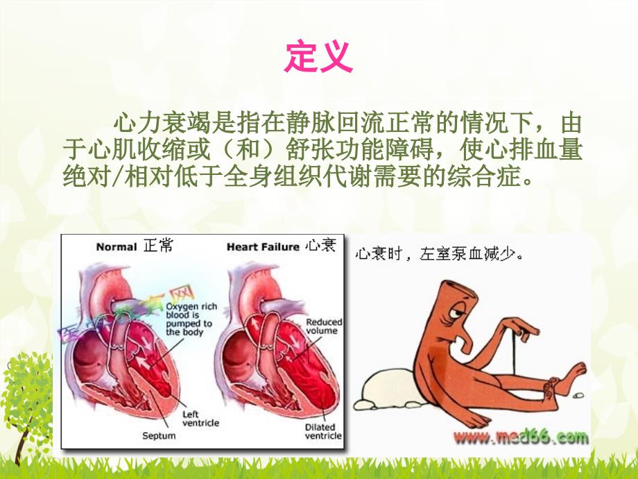 心力衰竭护理查房-_第3页