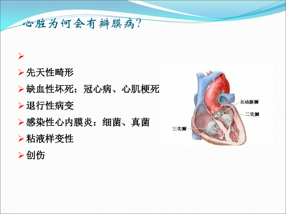 心脏瓣膜病第八版课件_第4页