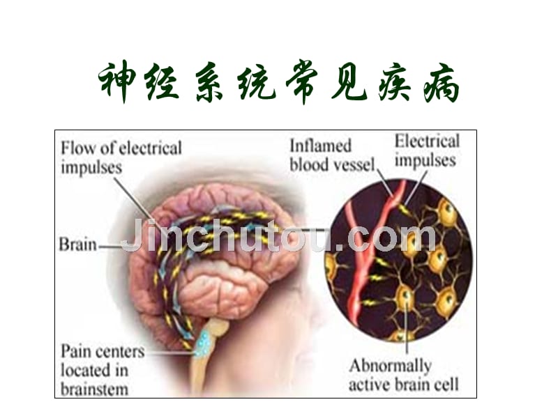 神经系统常见疾病ppt_第1页