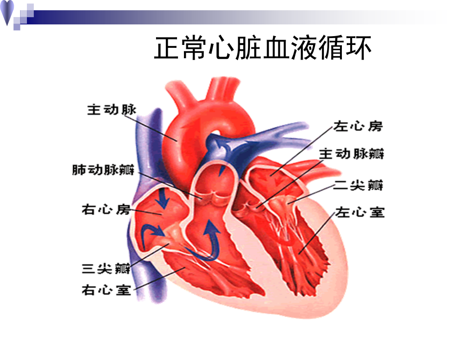 心脏瓣膜病ppt课件68950_第3页
