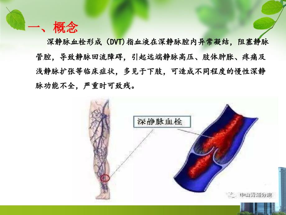 深静脉血栓预防与护理汪_第3页