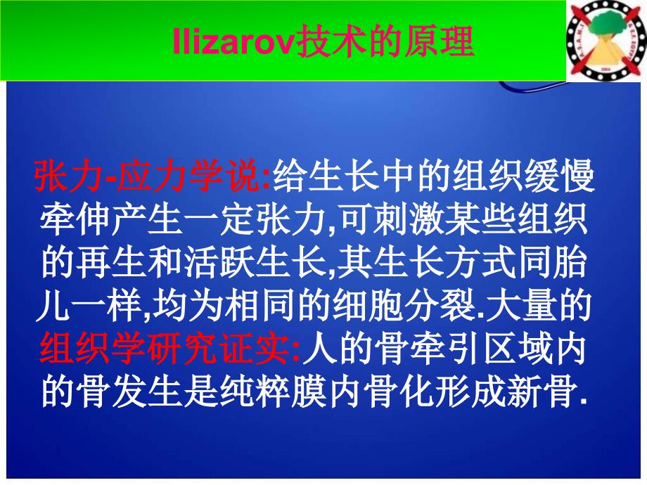 环式多功能外固定支架课件_第4页