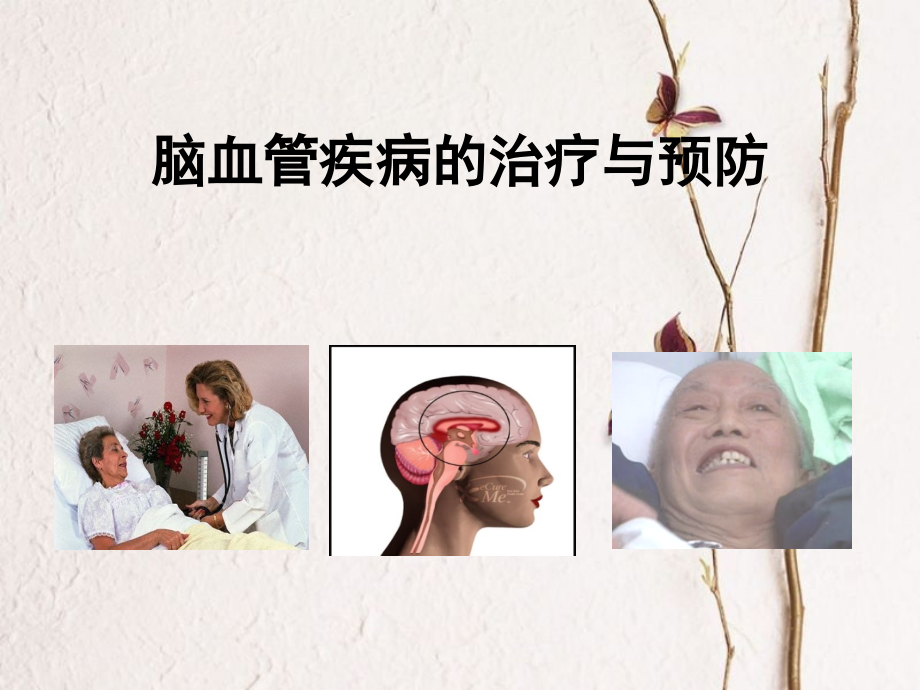 脑血管疾病治疗与预防_第1页