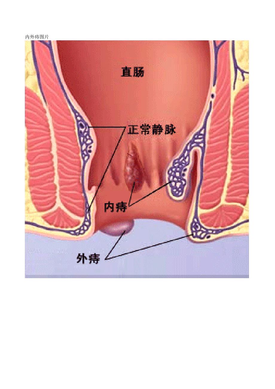 肛门解剖图_第2页