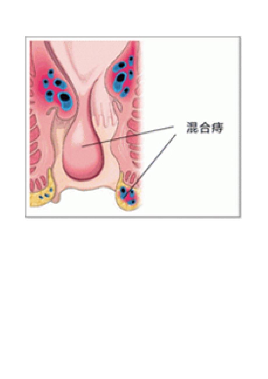 肛门解剖图_第3页