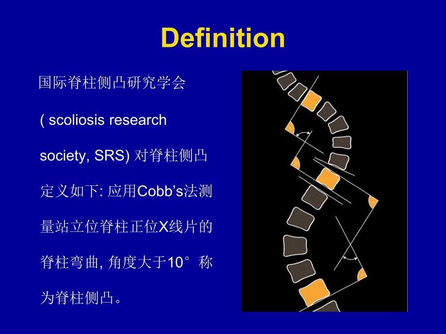 脊柱侧凸手术围术期管理_第5页