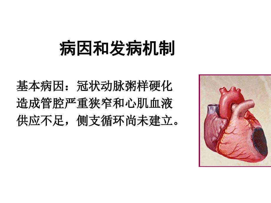 心梗患者便秘护理_第4页