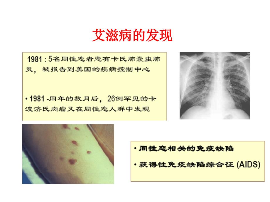 艾滋病及性传播疾病课件pptppt_第4页