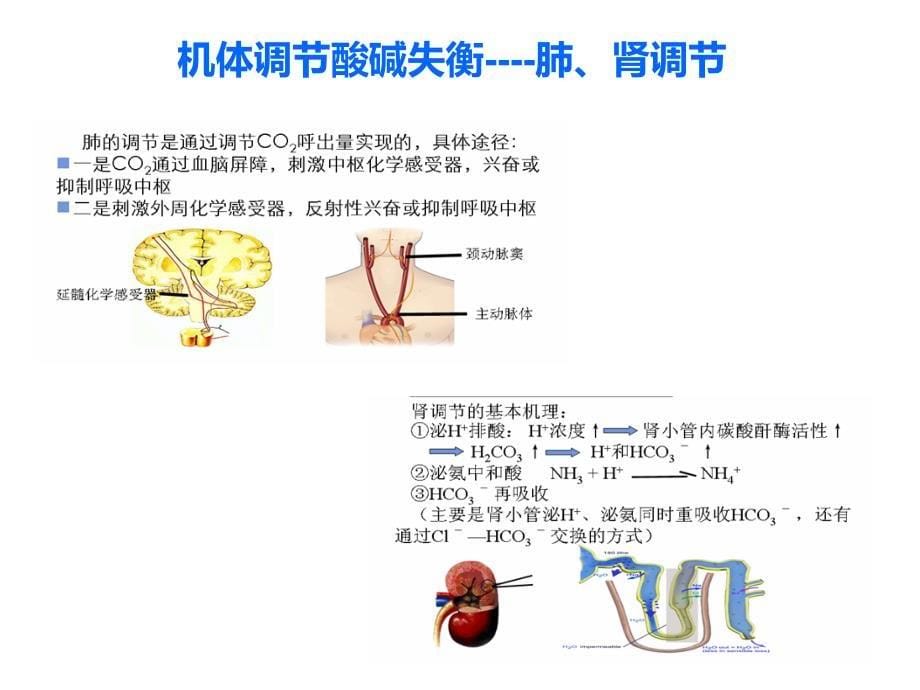 酸碱失衡的处理-_第5页