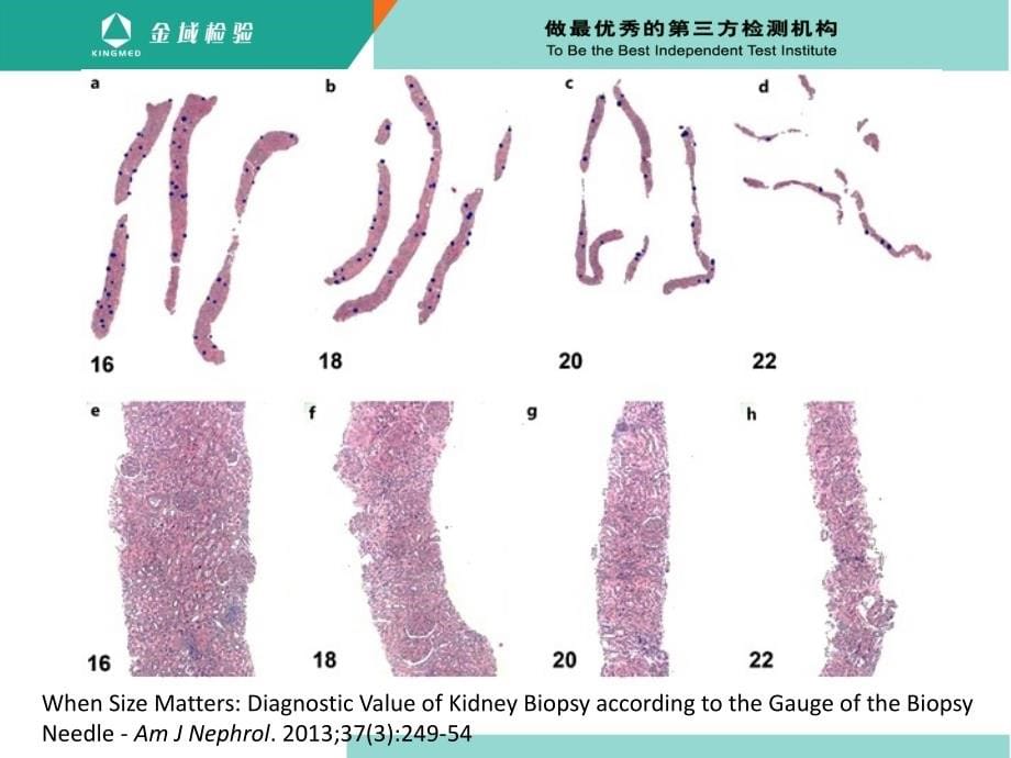 肾科医师需要了解的肾脏病理知识_第5页