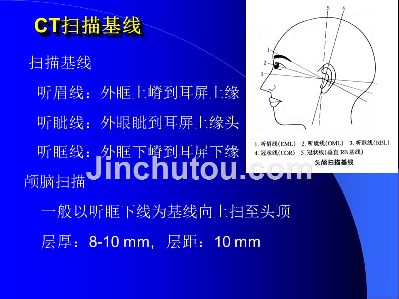 头颅ct课件_第3页