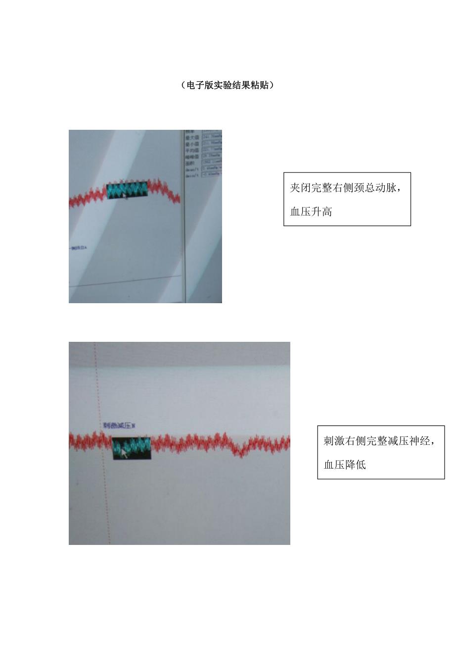 家兔动脉血压的调节(新)_第4页