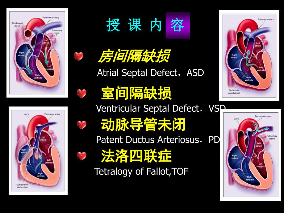先天性心脏病血液动力学改变_第4页