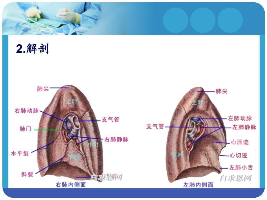 胸腔镜下肺叶切除手术配合22867_第5页