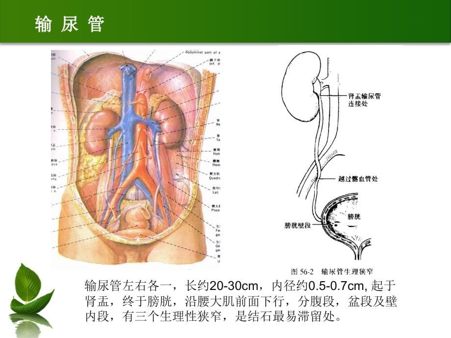 新-泌尿系结石的诊断及治疗 -王新平2018-03-01_第5页