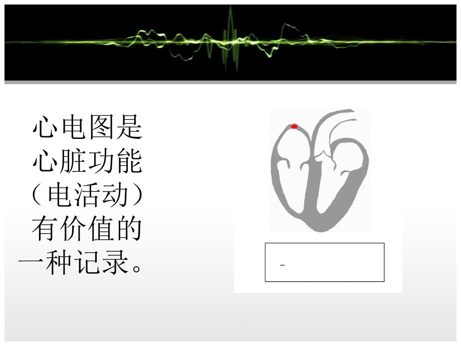 心电图基础(修改后)_第2页