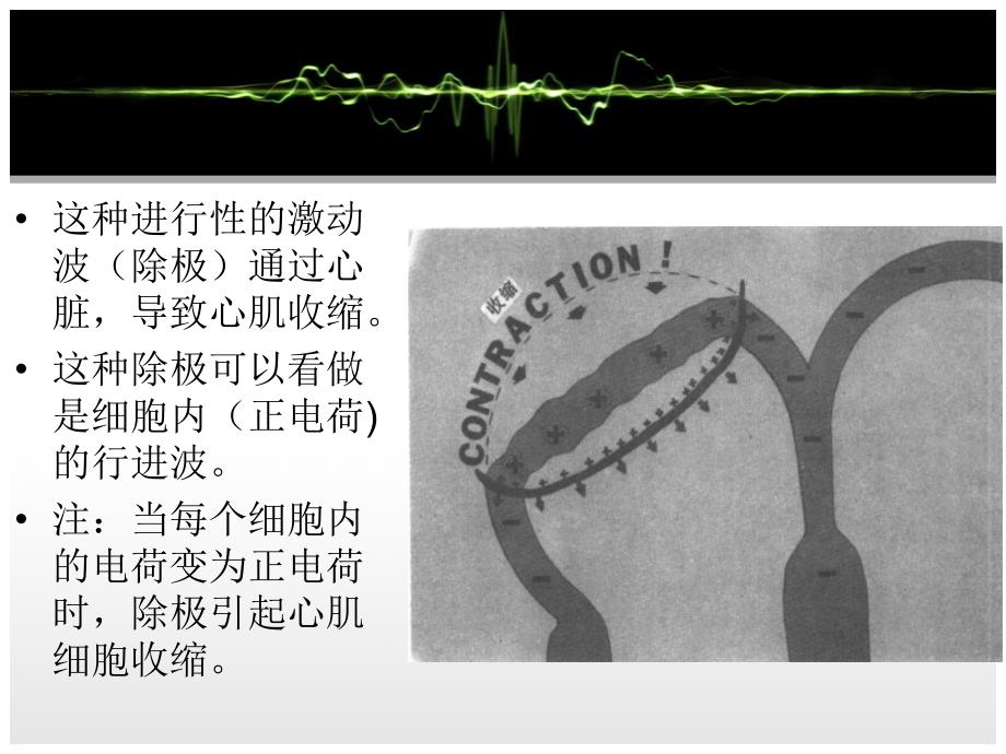 心电图基础(修改后)_第4页