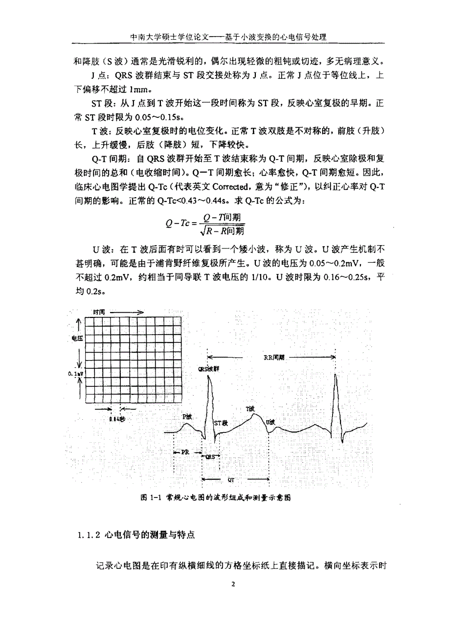 基于小波变换心电信号处理_第4页