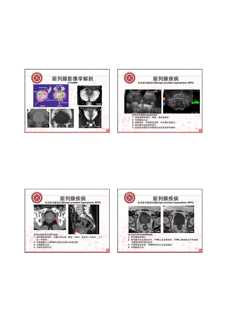 男性生殖系统影像学诊断_第2页