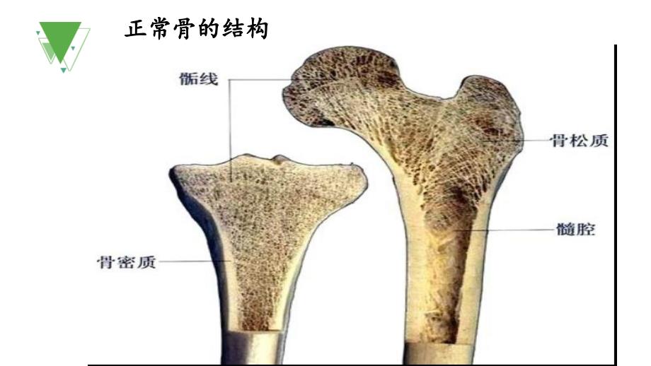 糖尿病干部病房_课件_第3页