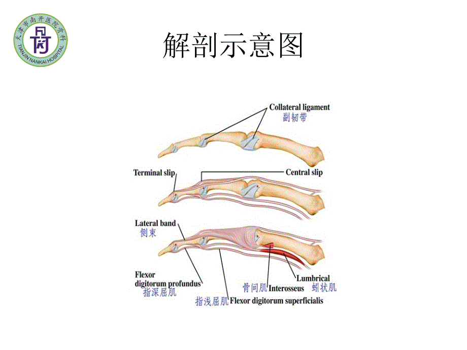 锤状指_第4页