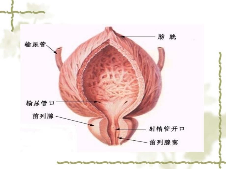 良性前列腺增生症病人护理_第5页