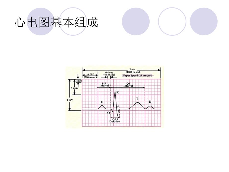 心电图 原件_第2页