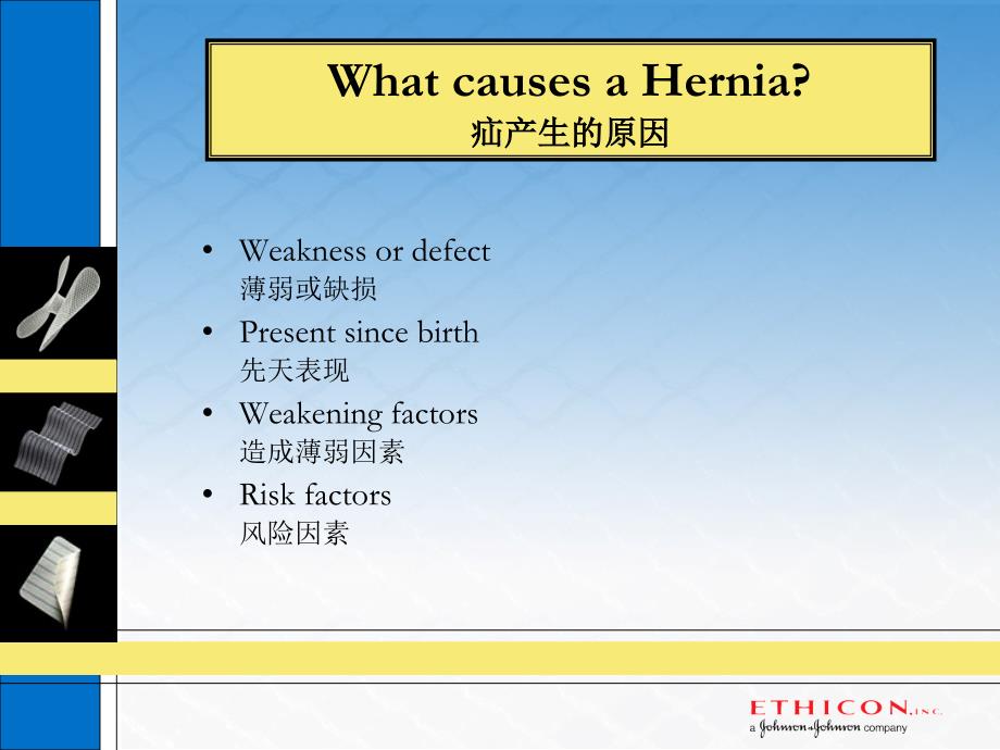 腹股沟区和腹壁的解剖和手术_第4页