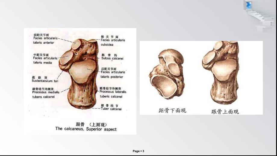 跟骨骨折的解剖特点和常用分析型_第3页