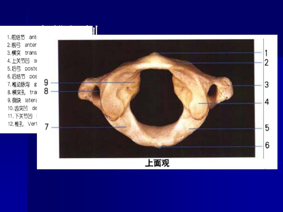 寰枢关节半脱位ppt课件_第3页