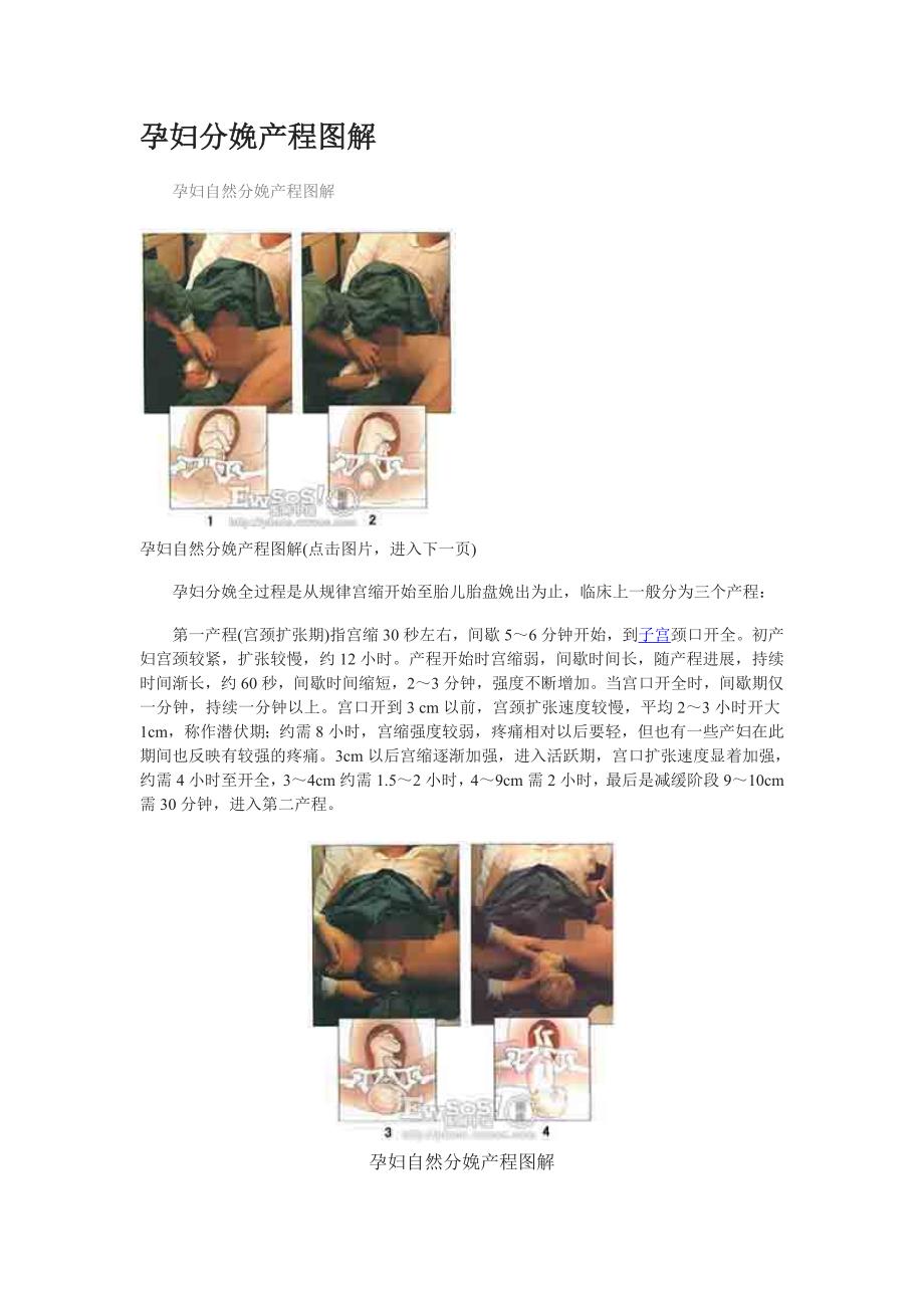 孕妇分娩产程图解_第1页