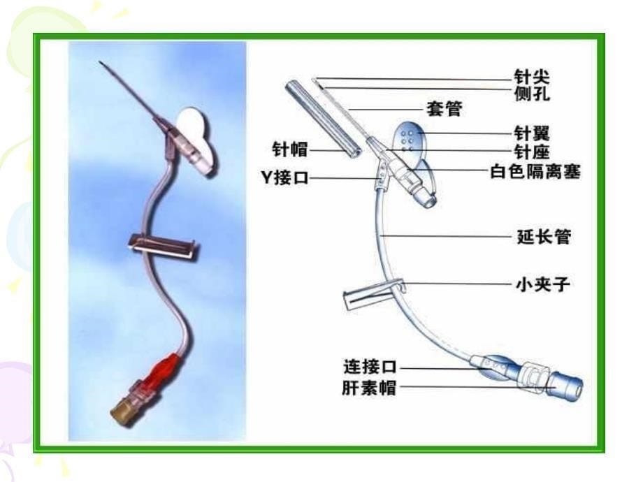 浅静脉留置针应用及维护-（精）_第5页