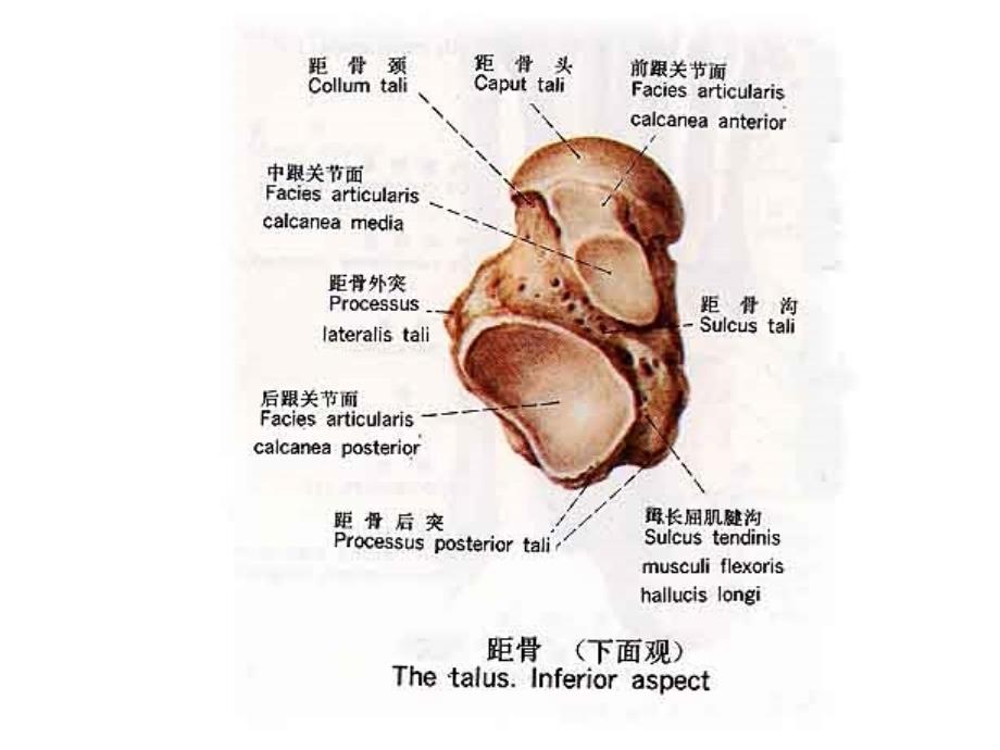 距骨骨折英文_第3页