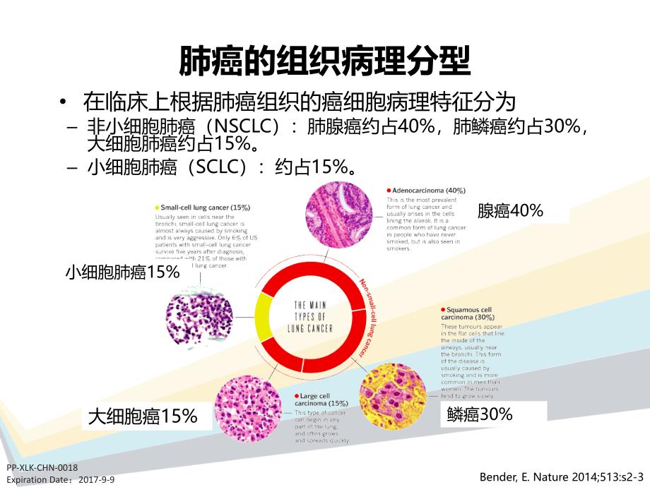 肺癌全程治疗之alk阳性非小细胞肺癌ppt课件_第4页