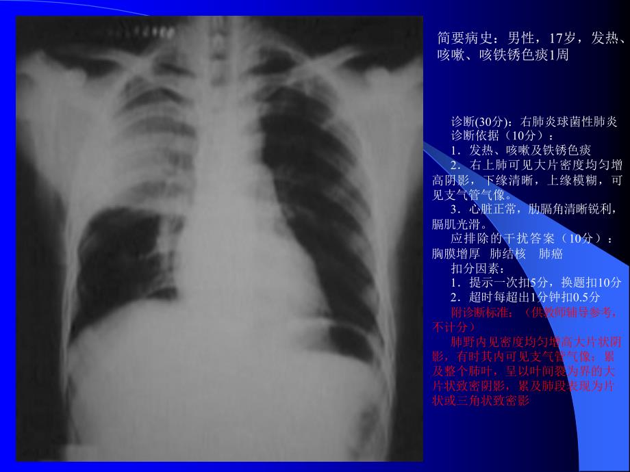 x线读片ppt课件_第3页