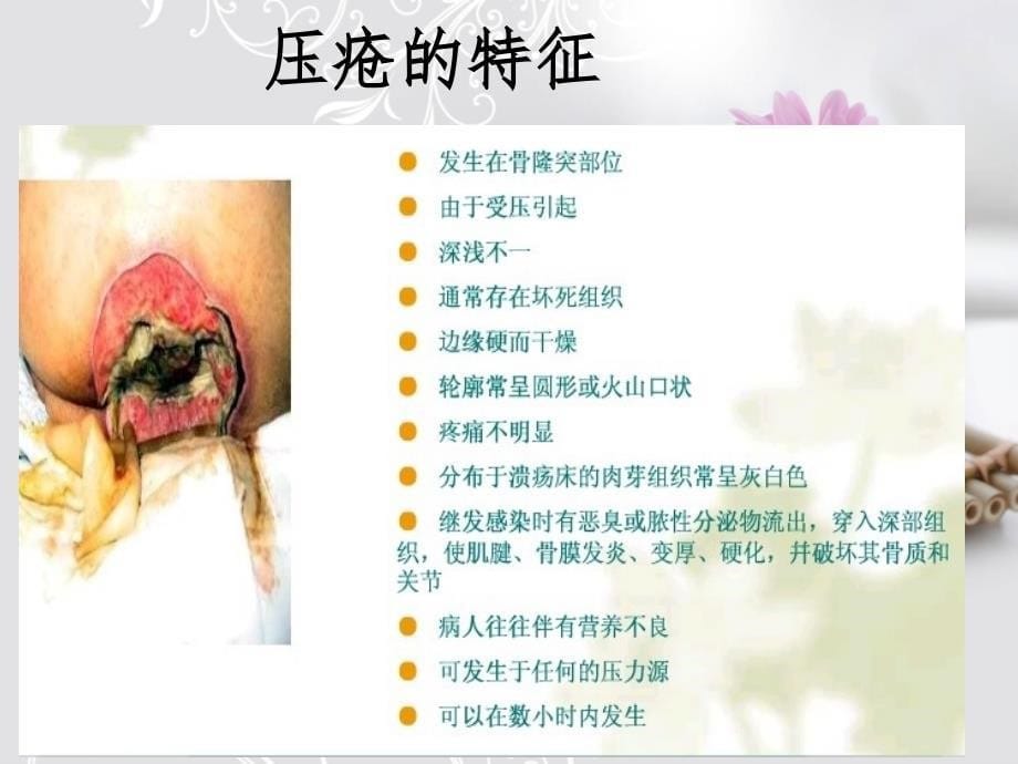 压疮的预防护理.ppt_第5页